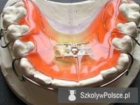 Galeria Szkoła Policealna Techniki Dentystycznej w Łodzi